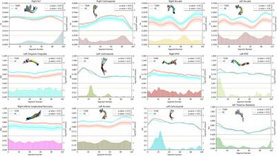 Tractography in Type 2 Diabetes Mellitus With Subjective Memory Complaints: A Diffusion Tensor Imaging Study
